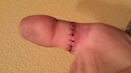 thumbstitches.jpg